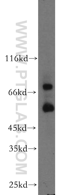 MMP2 Polyclonal antibody