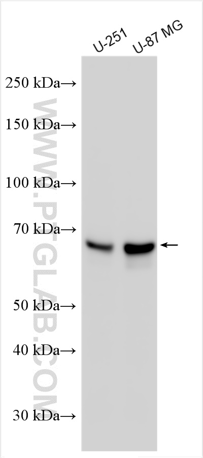 WB analysis using 66366-1-Ig