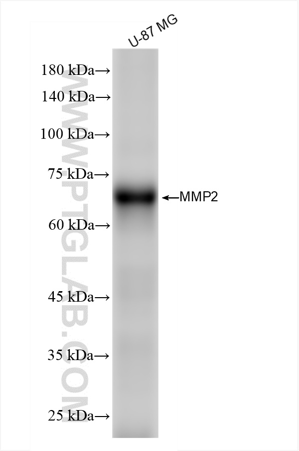 WB analysis of U-87 MG using 81515-5-RR