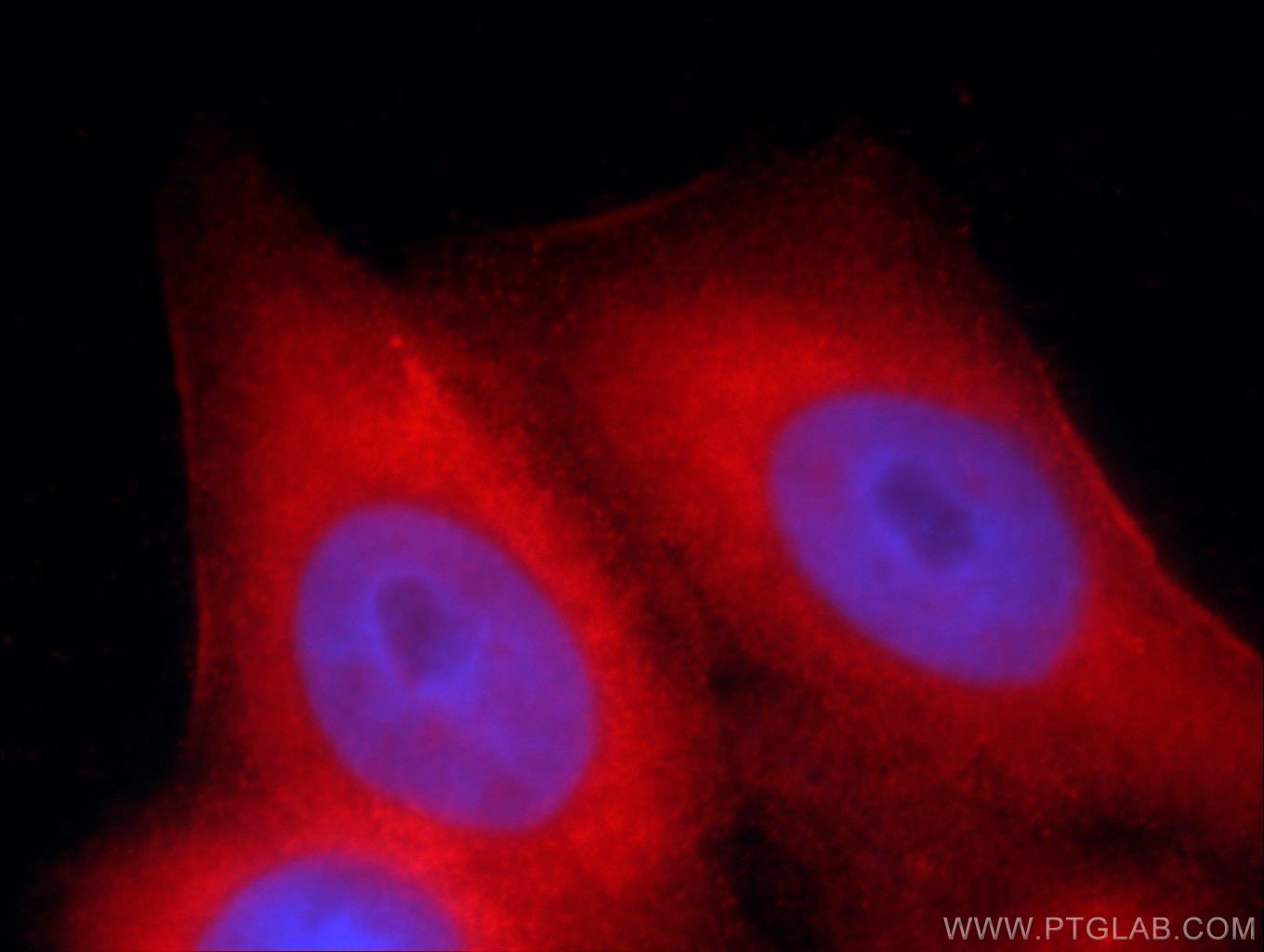 IF Staining of HeLa using 55467-1-AP