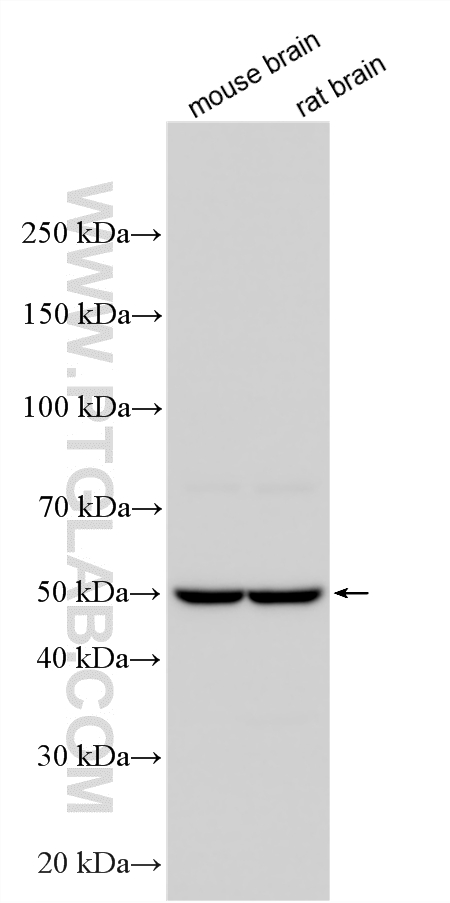 Various lysates were subjected to SDS PAGE followed by western blot with 55467-1-AP (MMP20 antibody) at dilution of 1:2000 incubated at room temperature for 1.5 hours. WB analysis using 55467-1-AP