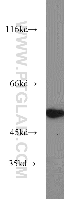 WB analysis of mouse brain using 55467-1-AP