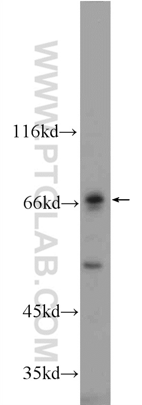 WB analysis of mouse liver using 55289-1-AP