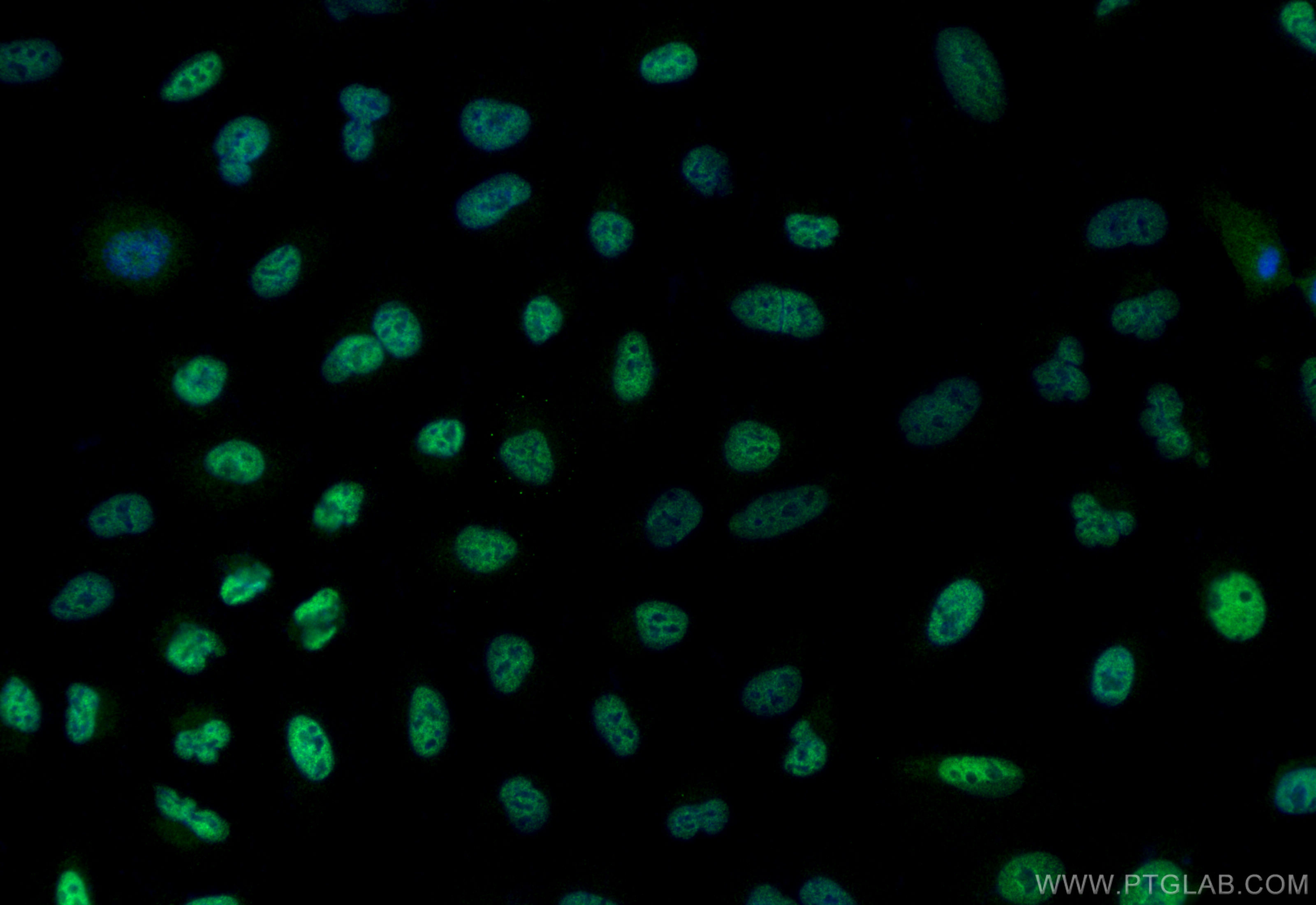 IF Staining of A549 using 30655-1-AP