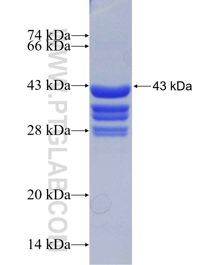 MMP25 fusion protein Ag29304 SDS-PAGE