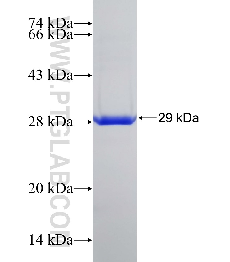 MMP26 fusion protein Ag12551 SDS-PAGE MMP26 fusion protein Ag12551 SDS-PAGE