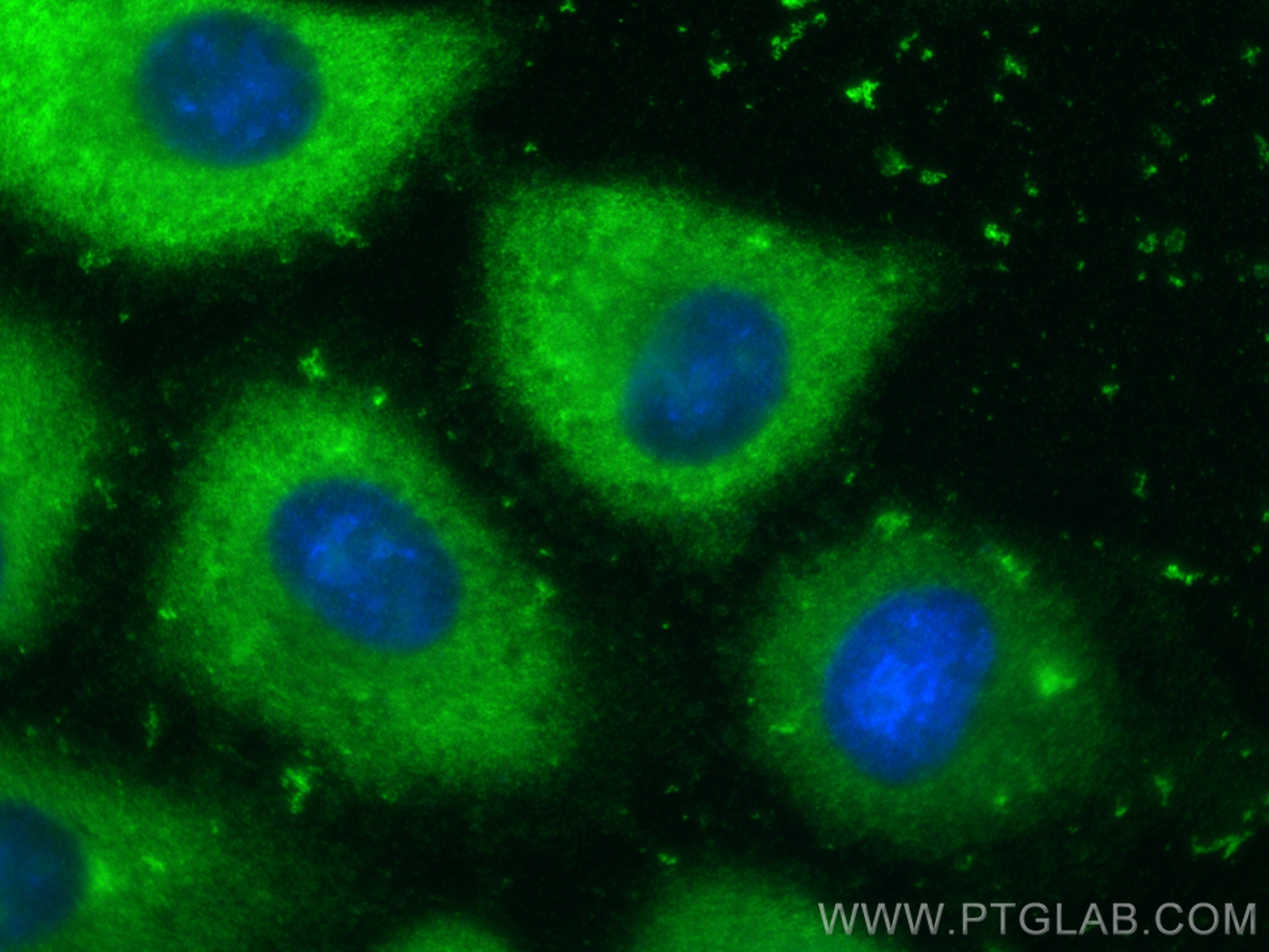 IF Staining of A549 using 18237-1-AP