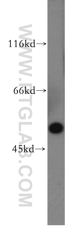 WB analysis of A549 using 18237-1-AP