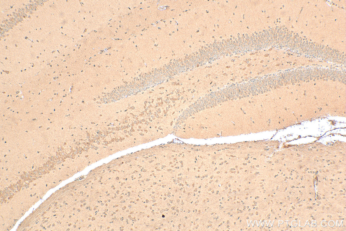 IHC staining of mouse brain using 17873-1-AP