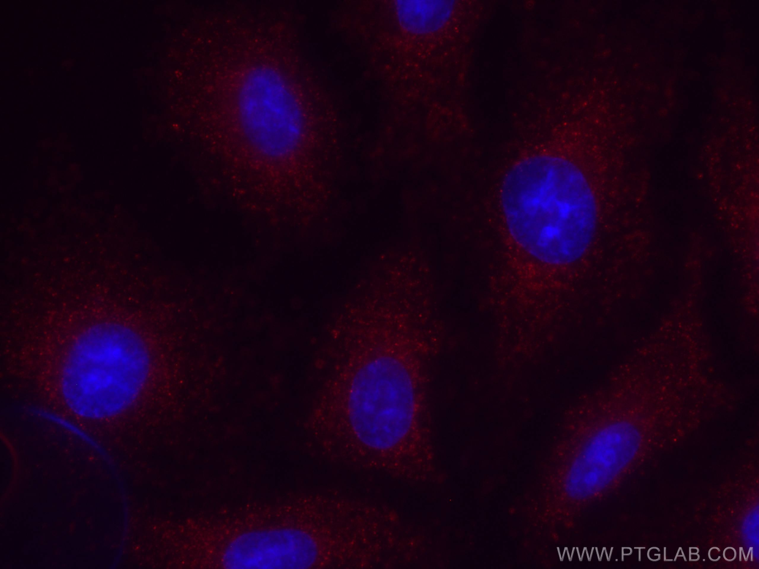 IF Staining of A549 using CL594-66338