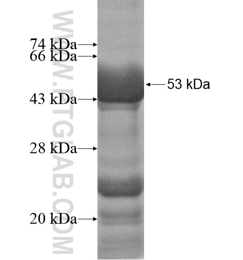 MMP3 fusion protein Ag12648 SDS-PAGE MMP3 fusion protein Ag12648 SDS-PAGE