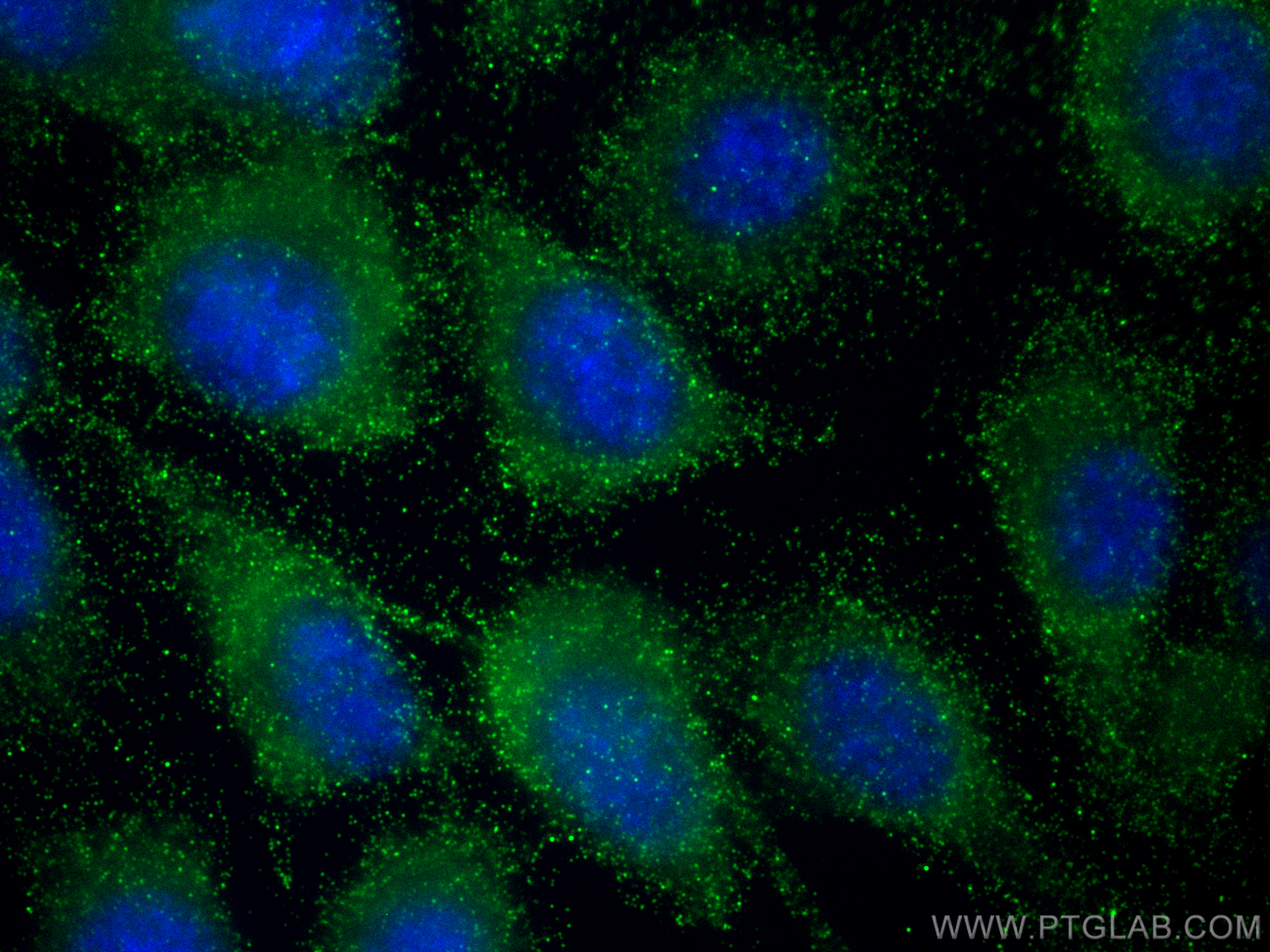 IF Staining of PC-3 using 67990-1-Ig (same clone as 67990-1-PBS)