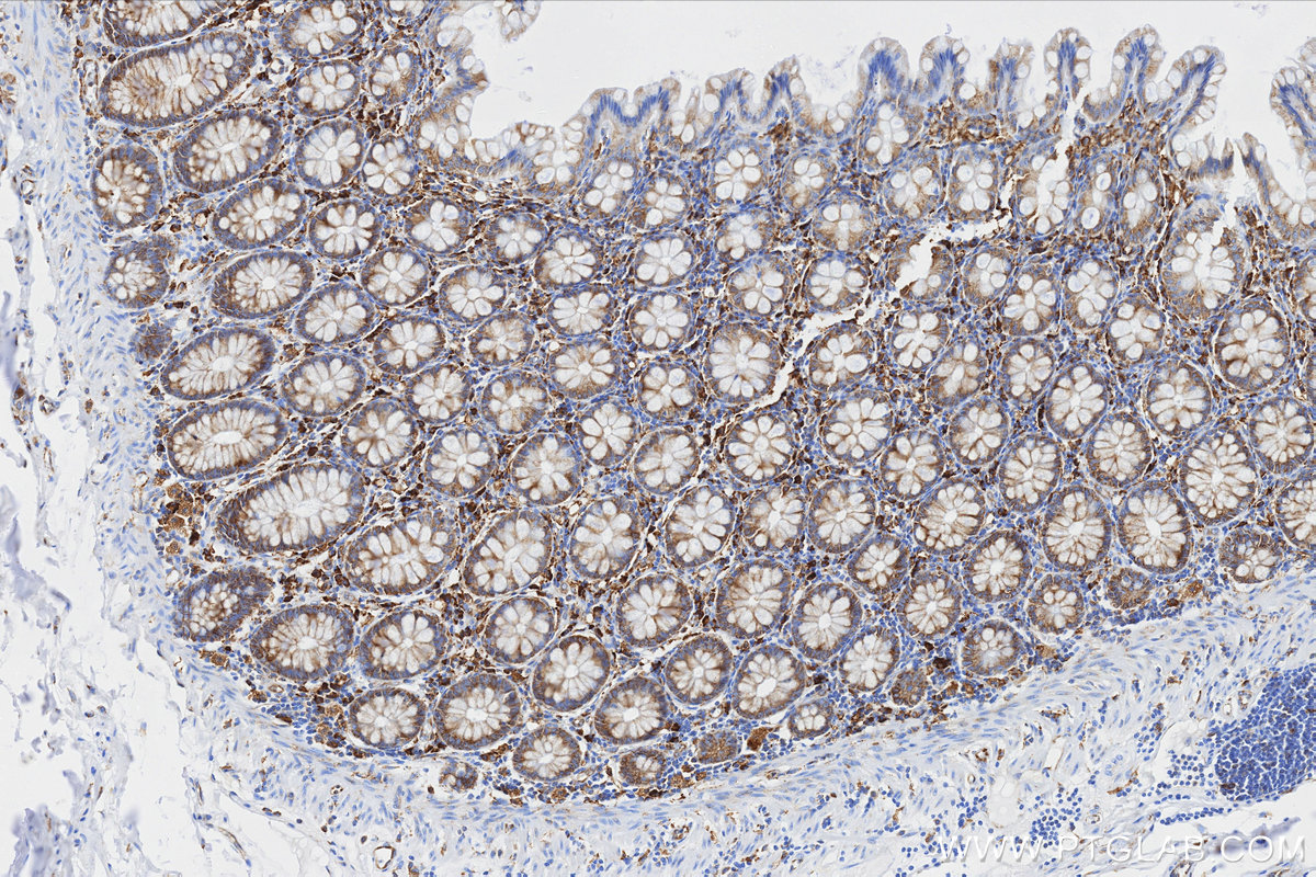 IHC staining of human colon using 87552-1-RR
