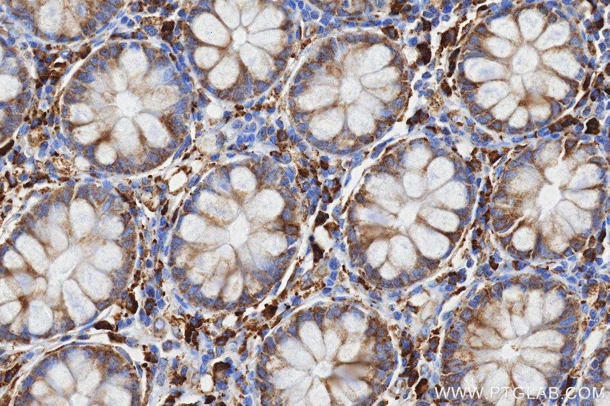 IHC staining of human colon using 87552-1-RR