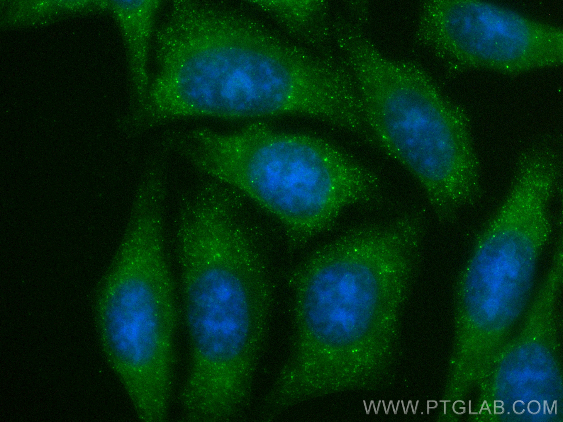IF Staining of HepG2 using 82885-1-RR