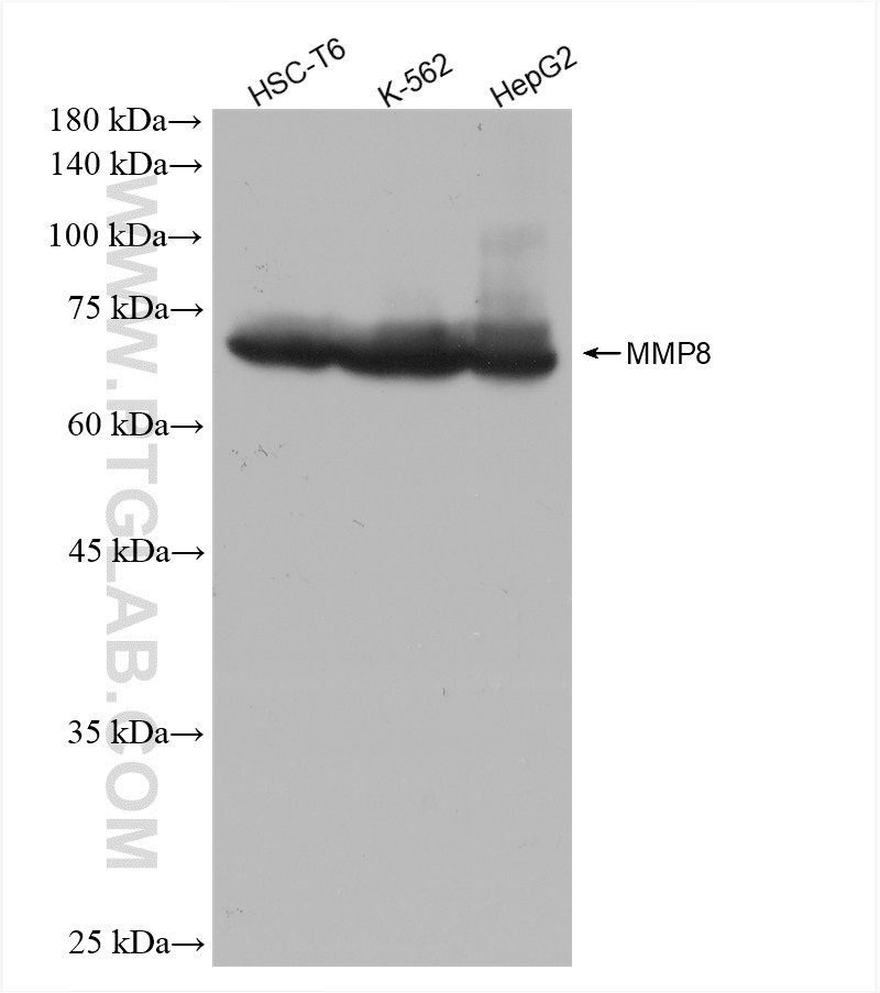 WB analysis using 82885-1-RR