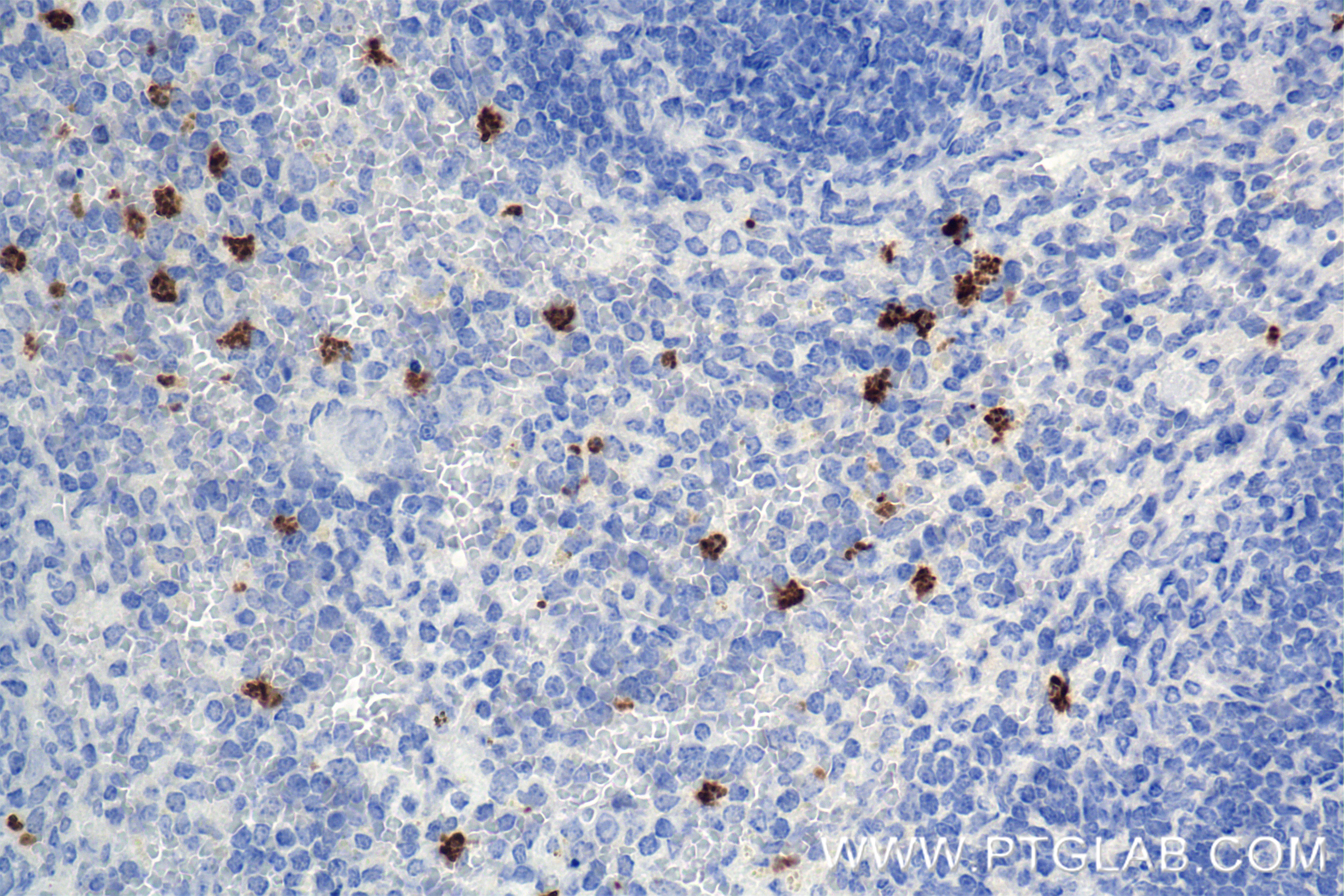 Immunohistochemical analysis of paraffin-embedded mouse spleen tissue slide using 85211-4-RR (MMP8 antibody) at dilution of 1:2000 (under 40x lens). Heat mediated antigen retrieval with Tris-EDTA buffer (pH 9.0). IHC staining of mouse spleen using 85211-4-RR