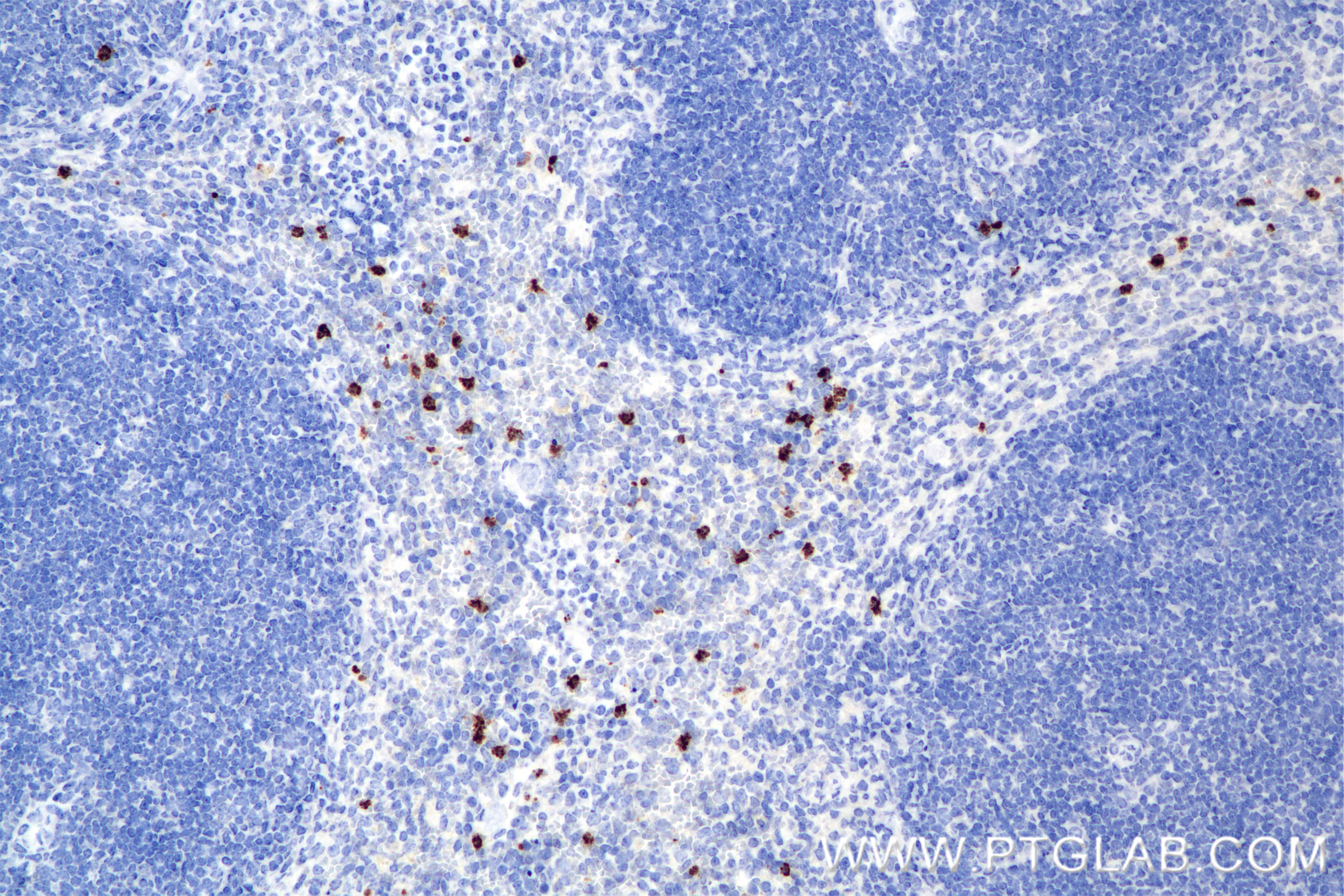 Immunohistochemical analysis of paraffin-embedded mouse spleen tissue slide using 85211-4-RR (MMP8 antibody) at dilution of 1:2000 (under 20x lens). Heat mediated antigen retrieval with Tris-EDTA buffer (pH 9.0). IHC staining of mouse spleen using 85211-4-RR