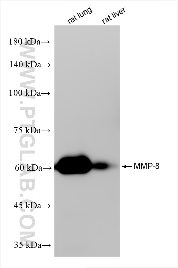 Various lysates were subjected to SDS PAGE followed by western blot with 85211-4-RR (MMP-8 antibody) at dilution of 1:10000 incubated at room temperature for 1.5 hours. WB analysis using 85211-4-RR