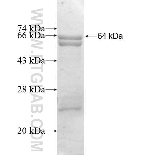 MMP8 fusion protein Ag12367 SDS-PAGE