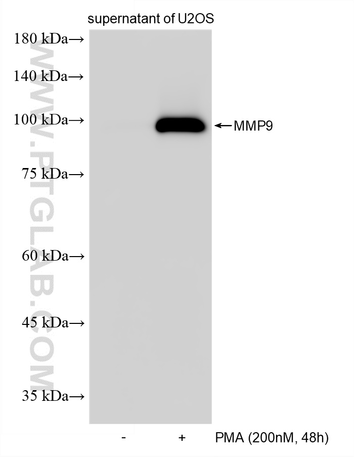 WB analysis of supernatant of U2OS using 82685-20-RR