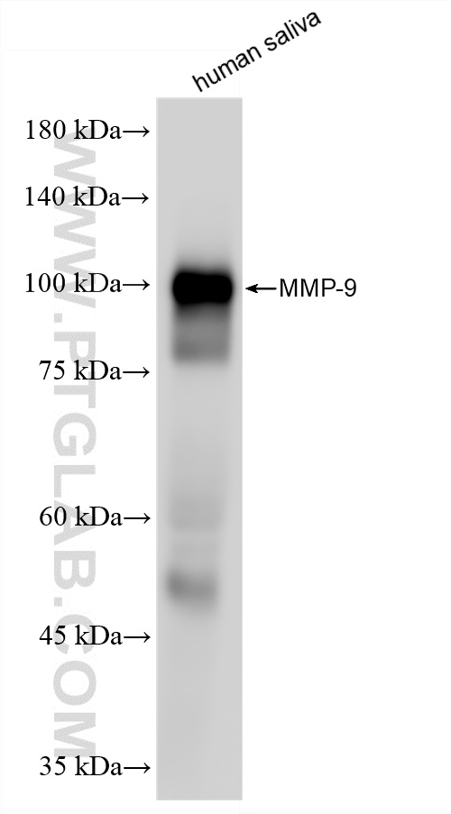 WB analysis of human saliva using 82685-20-RR