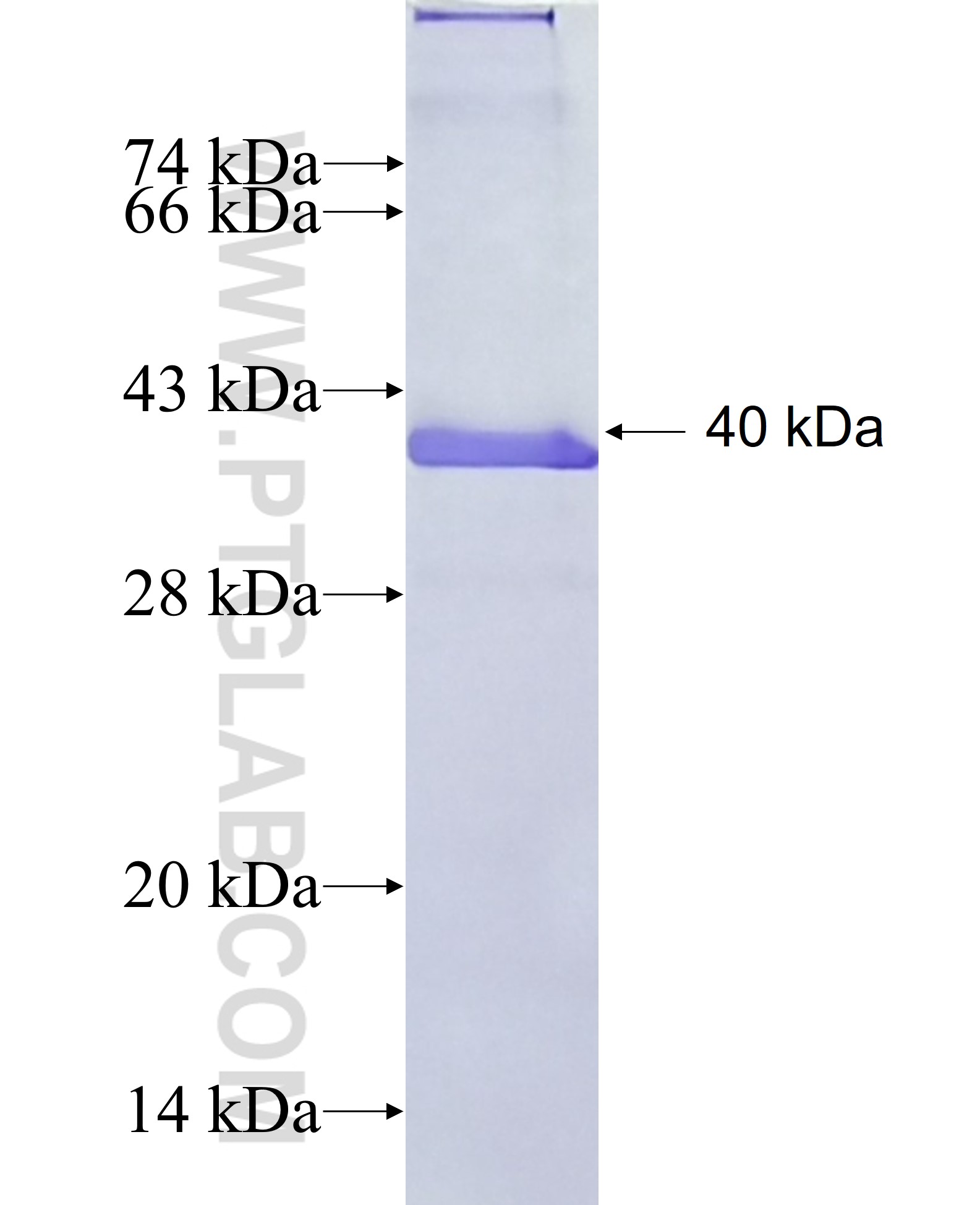 MMRN1 fusion protein Ag11739 SDS-PAGE