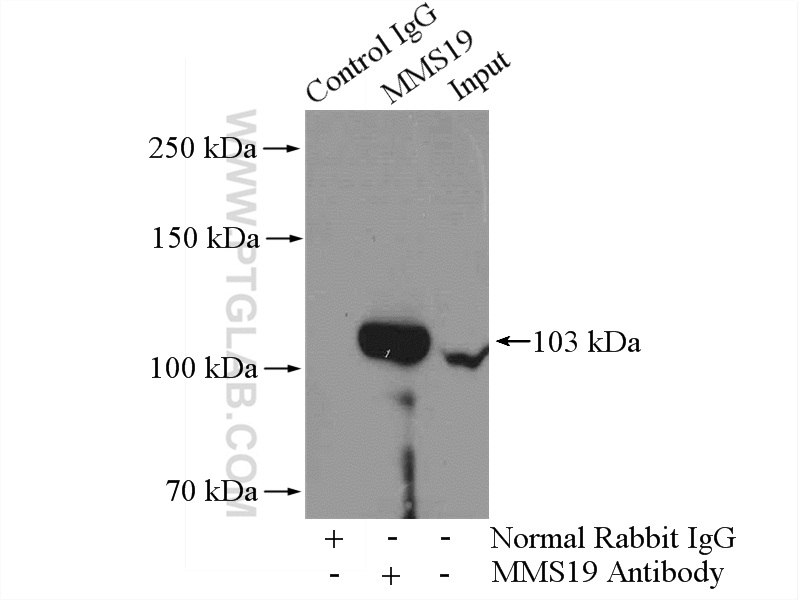 IP experiment of mouse brain using 66049-1-Ig