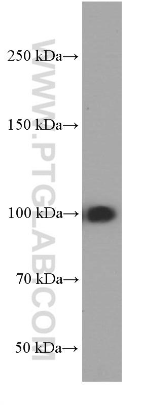 WB analysis of HeLa using 66049-1-Ig