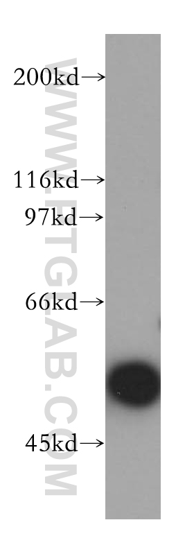 MNDA Polyclonal antibody