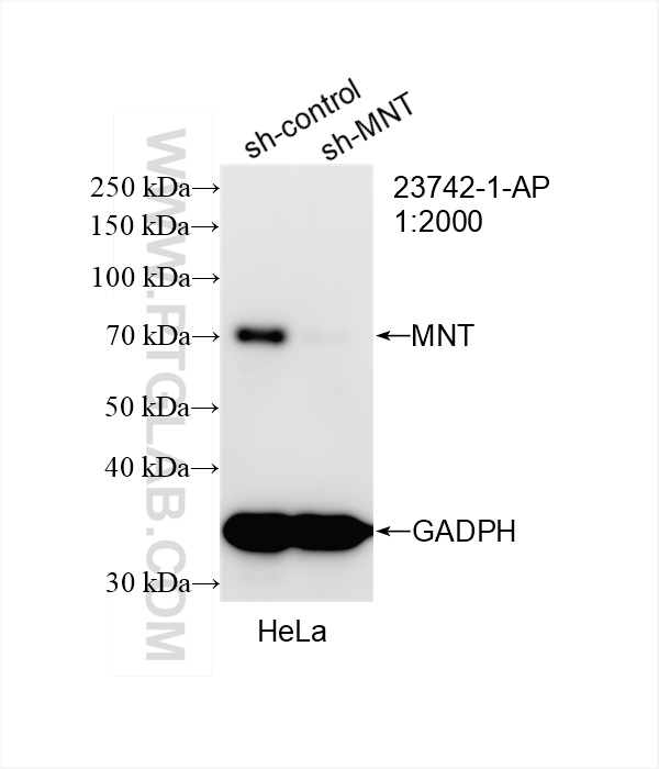 WB analysis of HeLa using 23742-1-AP