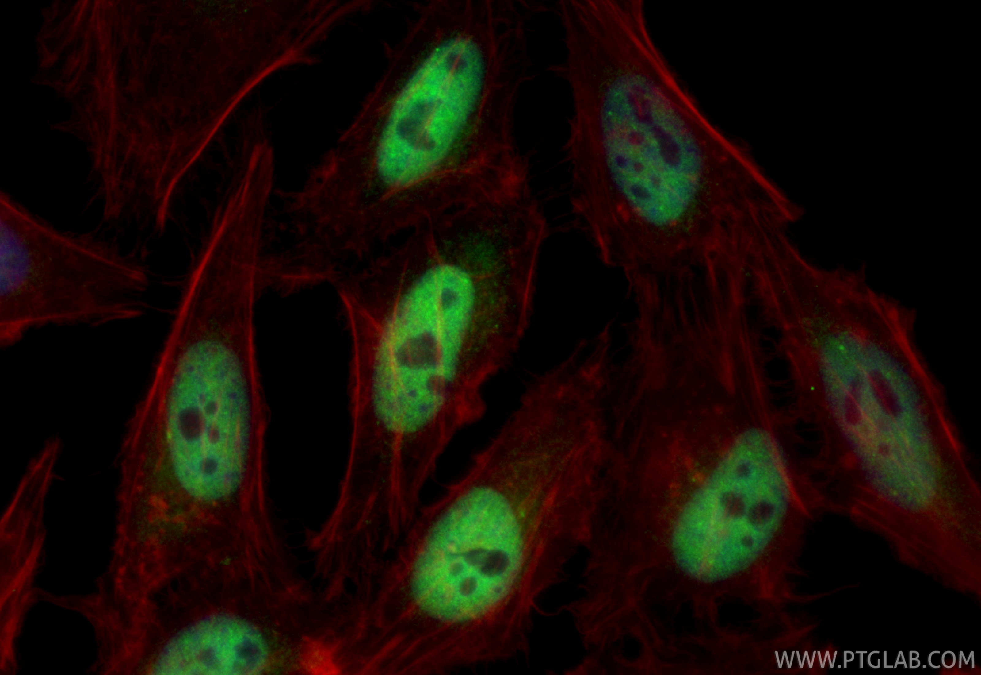 IF Staining of HeLa using CL488-83648