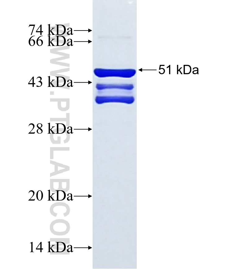 MNX1 fusion protein Ag37229 SDS-PAGE MNX1 fusion protein Ag37229 SDS-PAGE