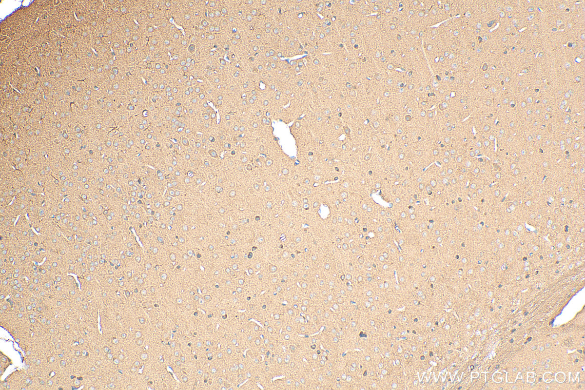 IHC staining of mouse brain using 15325-1-AP