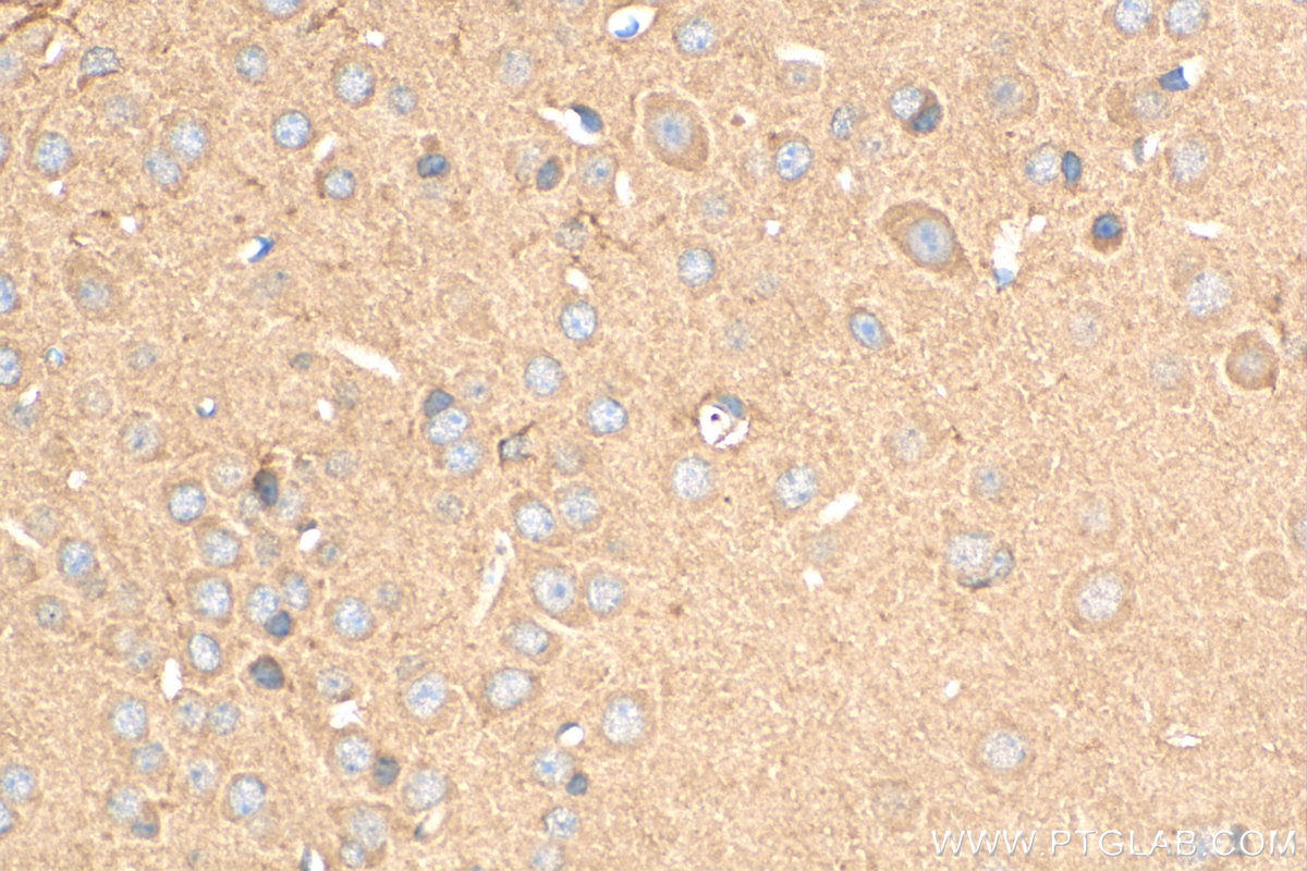 IHC staining of mouse brain using 15325-1-AP