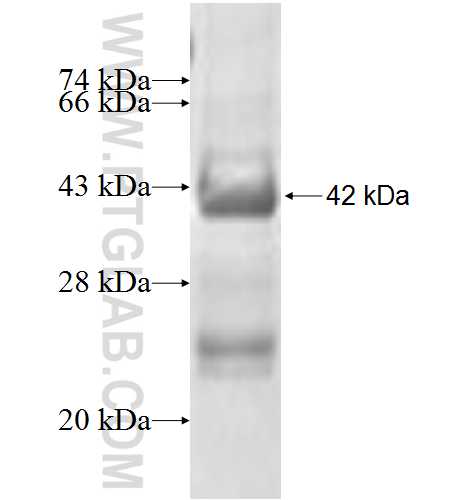 MOAP1 fusion protein Ag7793 SDS-PAGE MOAP1 fusion protein Ag7793 SDS-PAGE