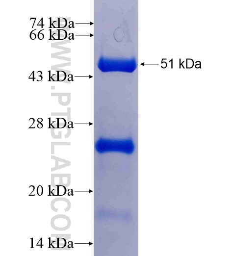 MOBKL1B fusion protein Ag2252 SDS-PAGE