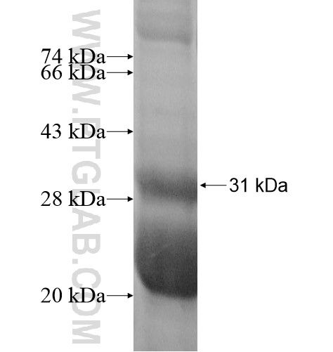 MOBKL2B fusion protein Ag11022 SDS-PAGE MOBKL2B fusion protein Ag11022 SDS-PAGE