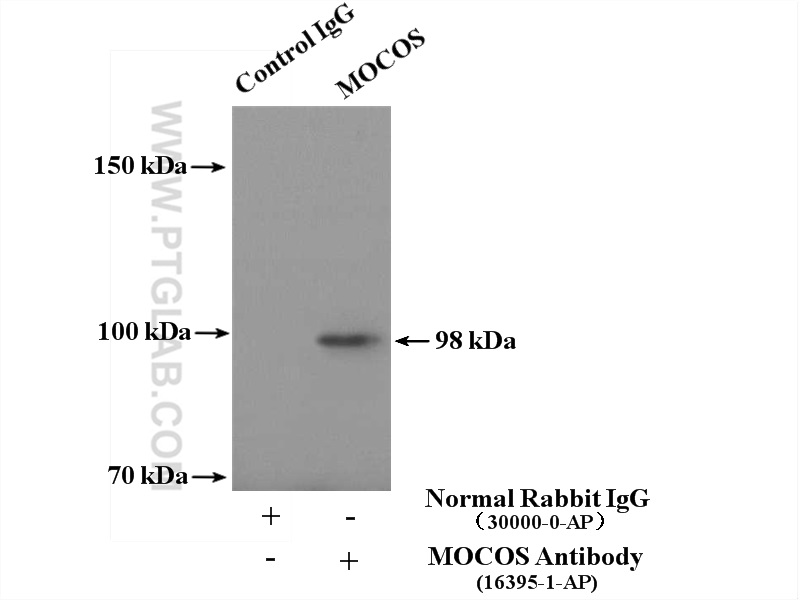 IP experiment of HepG2 using 16395-1-AP