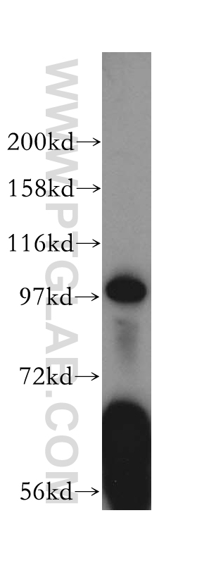 WB analysis of HepG2 using 16395-1-AP