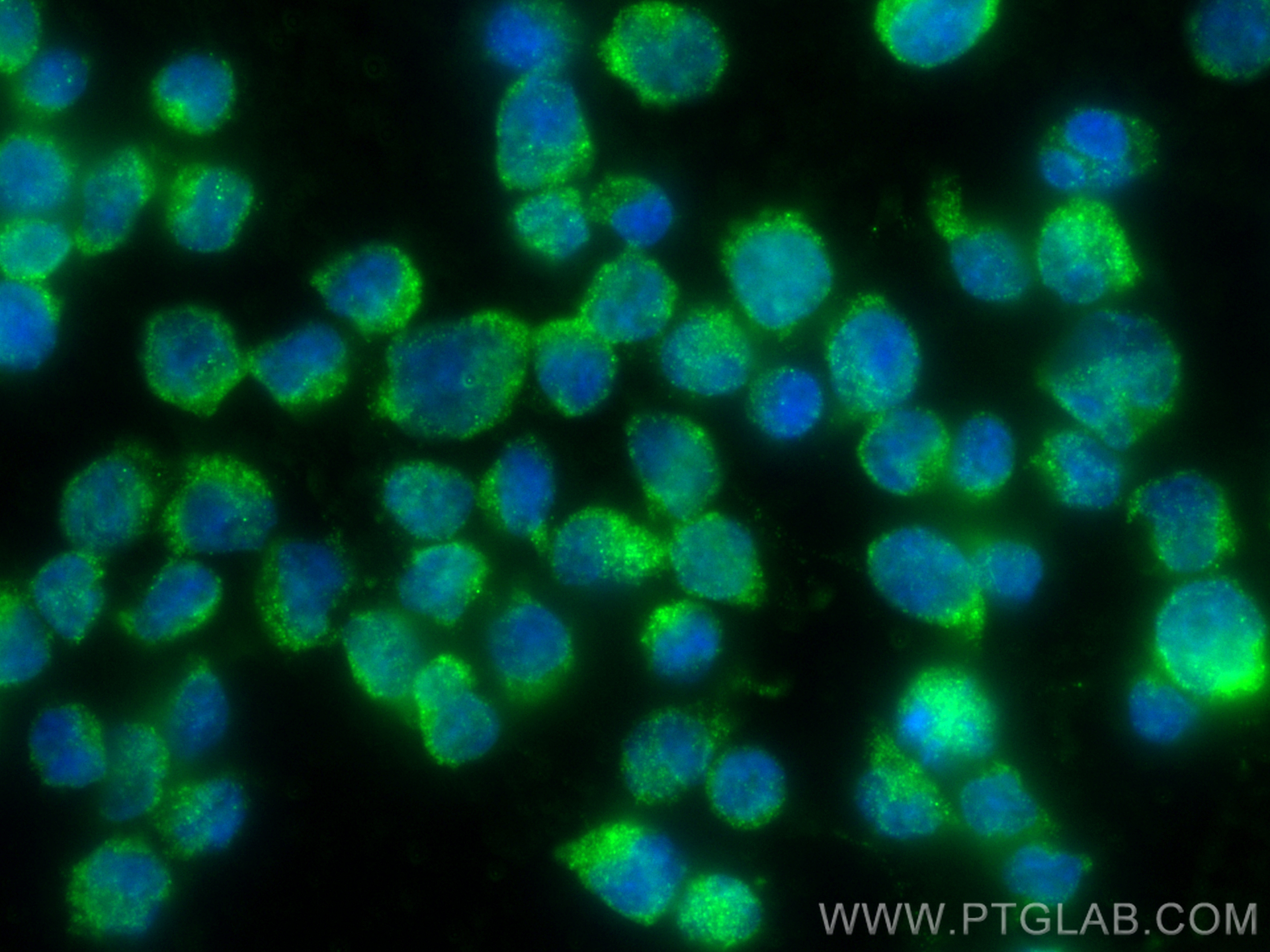 IF Staining of Jurkat using 31550-1-AP (same clone as 31550-1-PBS) IF Staining of Jurkat using 31550-1-AP (same clone as 31550-1-PBS)
