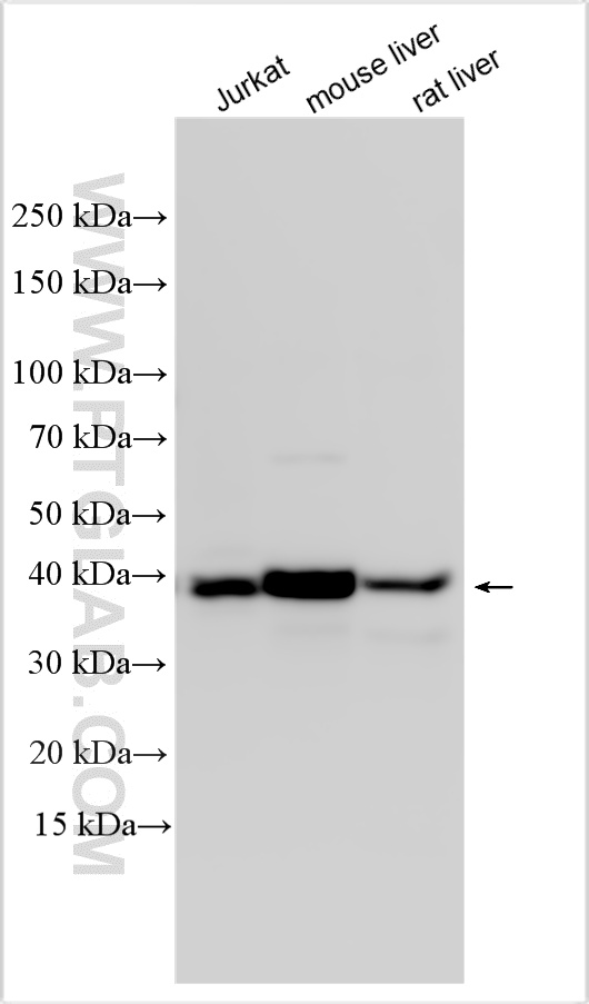 WB analysis using 31550-1-AP (same clone as 31550-1-PBS) WB analysis using 31550-1-AP (same clone as 31550-1-PBS)