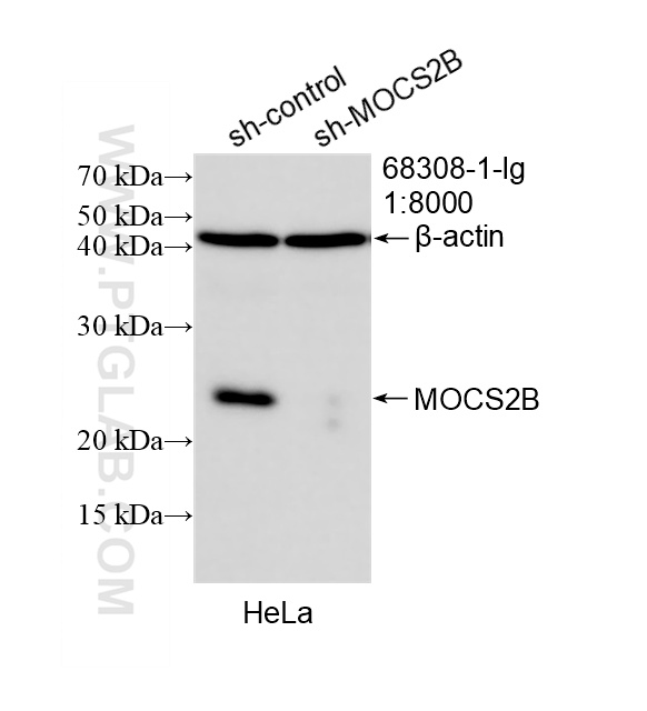 WB result of MOCS2 antibody (68308-1-Ig; 1:8000; incubated at room temperature for 1.5 hours) with sh-Control and sh-MOCS2B transfected HeLa cells. WB analysis of HeLa using 68308-1-Ig