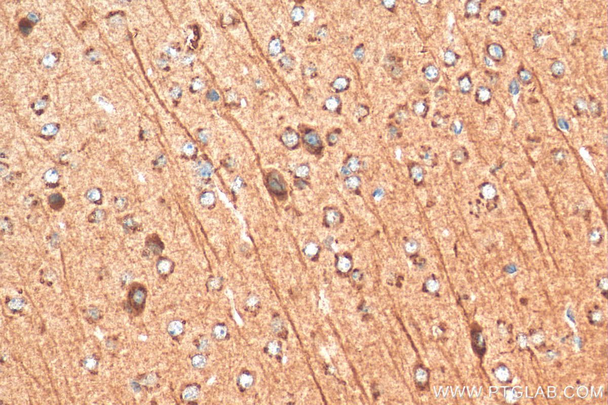 IHC staining of mouse brain using 12690-1-AP