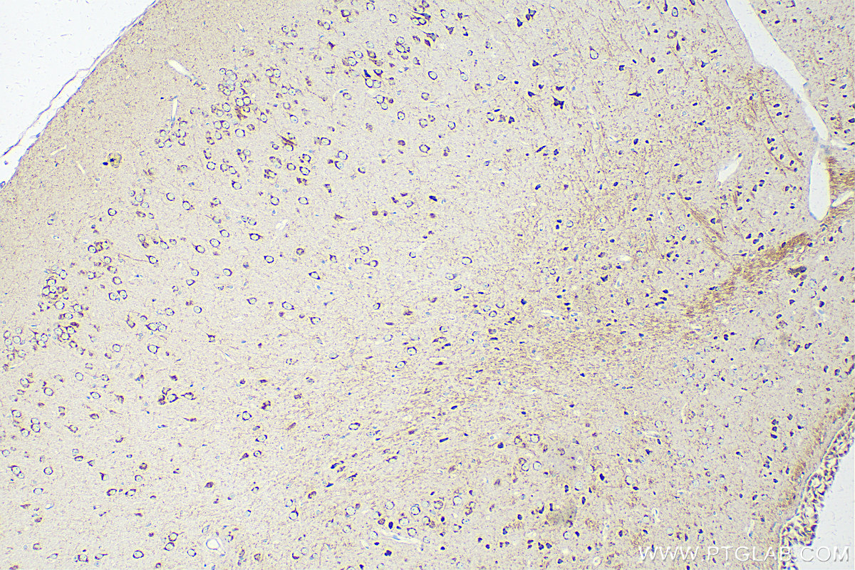 IHC staining of mouse brain using 12690-1-AP IHC staining of mouse brain using 12690-1-AP
