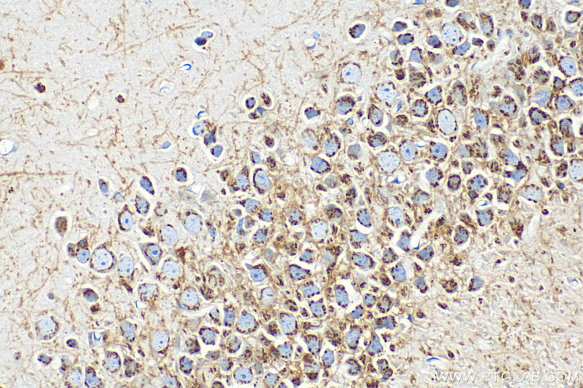 IHC staining of mouse brain using 12690-1-AP IHC staining of mouse brain using 12690-1-AP