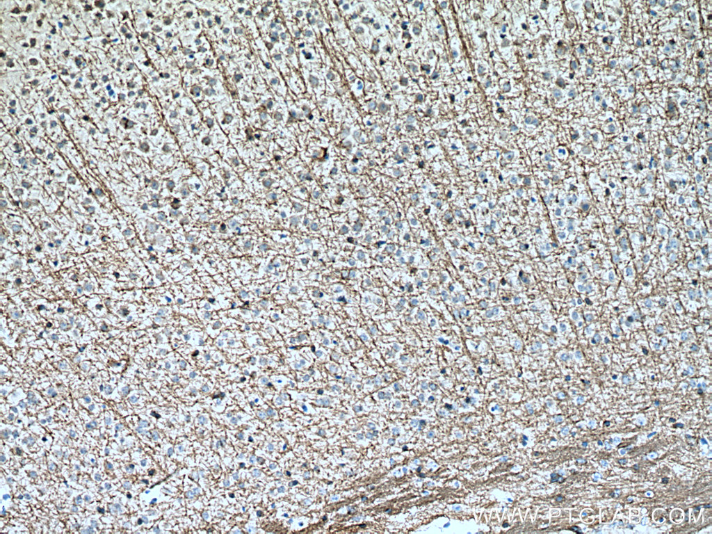 IHC staining of mouse brain using 28752-1-AP (same clone as 28752-1-PBS)