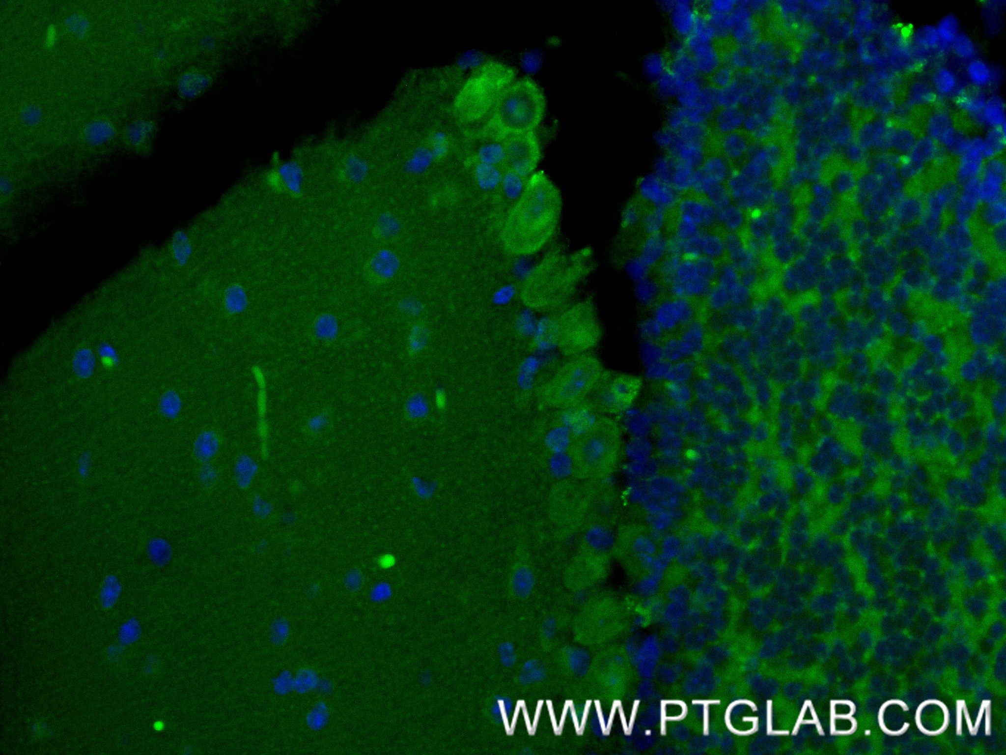 Immunofluorescent analysis of (4% PFA) fixed paraffin-embedded mouse cerebellum tissue using MOG antibody (83063-6-RR, Clone: 250235E1 ) at dilution of 1:400 and Multi-rAb CoraLite ® Plus 488-Goat Anti-Rabbit Recombinant Secondary Antibody (H+L) (RGAR002). Heat mediated antigen retrieval with Tris-EDTA buffer (pH 9.0). IF Staining of mouse cerebellum using 83063-6-RR