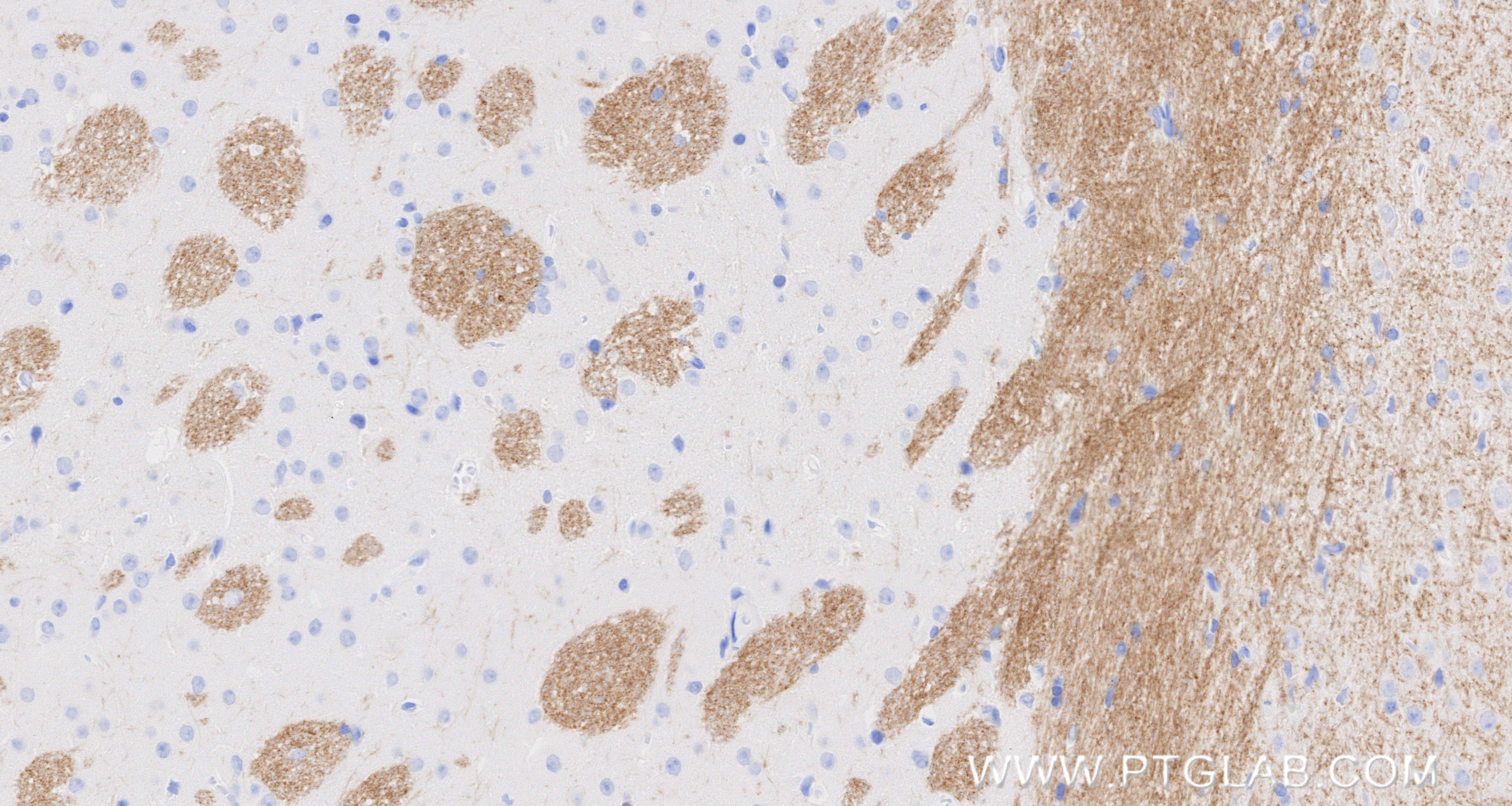 Immunohistochemical analysis of paraffin-embedded mouse brain tissue slide using 83063-6-RR (MOG antibody) at dilution of 1:500 (under 10x lens). Heat mediated antigen retrieval with Tris-EDTA buffer (pH 9.0). IHC staining of mouse brain using 83063-6-RR