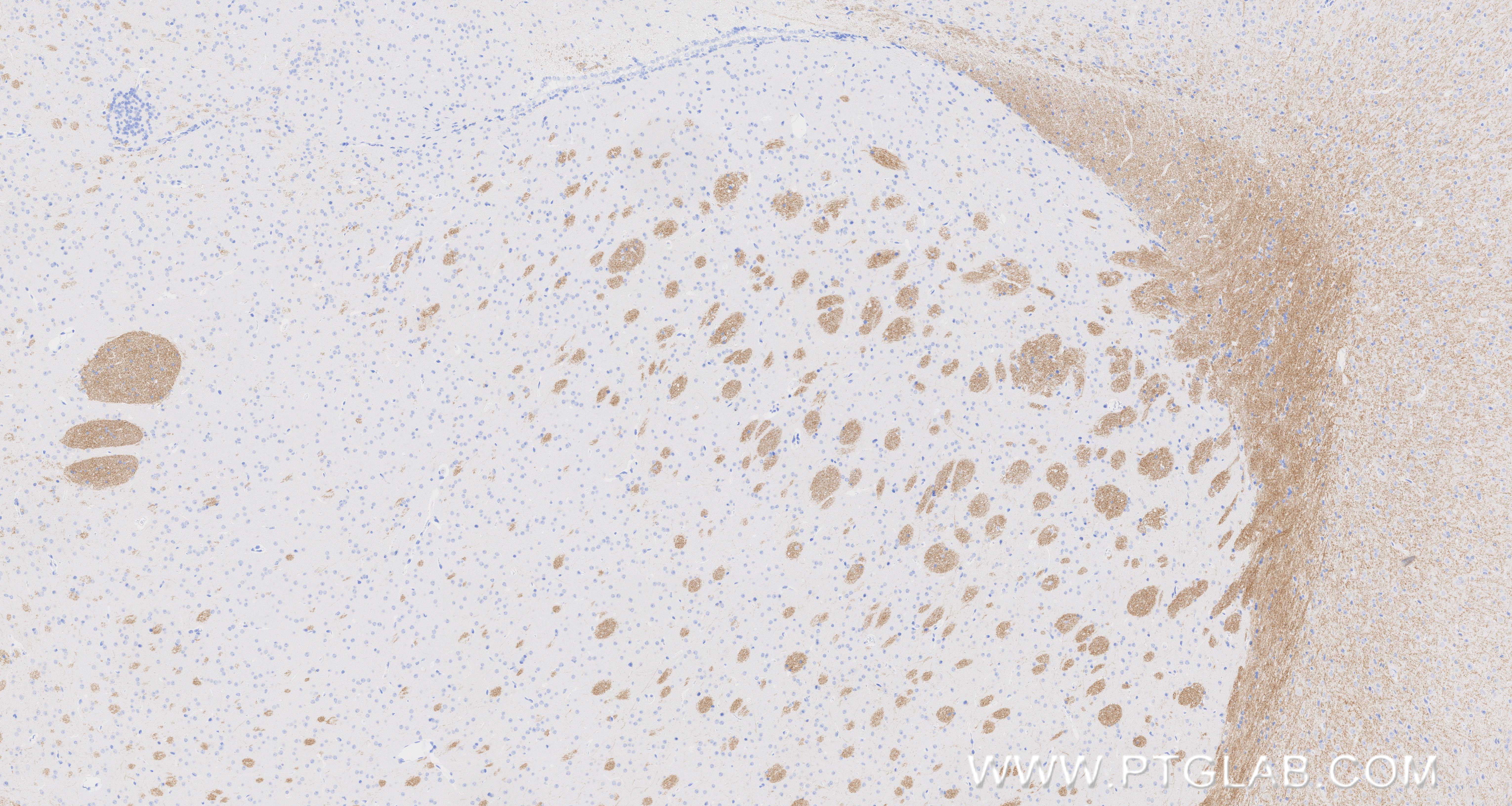 Immunohistochemical analysis of paraffin-embedded mouse brain tissue slide using 83063-6-RR (MOG antibody) at dilution of 1:500 (under 40x lens). Heat mediated antigen retrieval with Tris-EDTA buffer (pH 9.0). IHC staining of mouse brain using 83063-6-RR